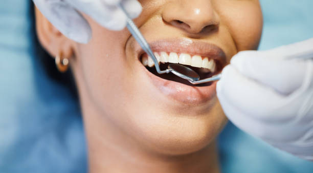 Best Emergency Dentist for Knocked-Out Tooth in Carolina Beach, NC
